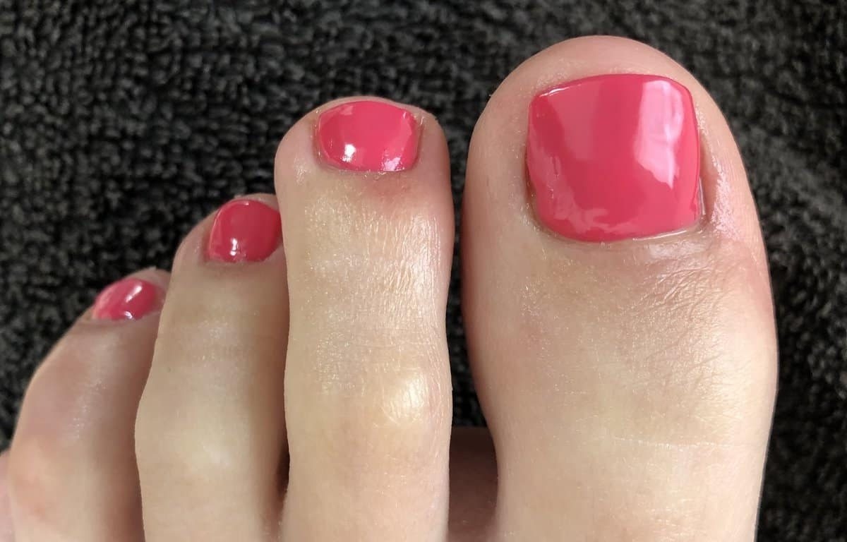 Nail Reconstruction And Nail Replacement - The Foot and Ankle Clinic