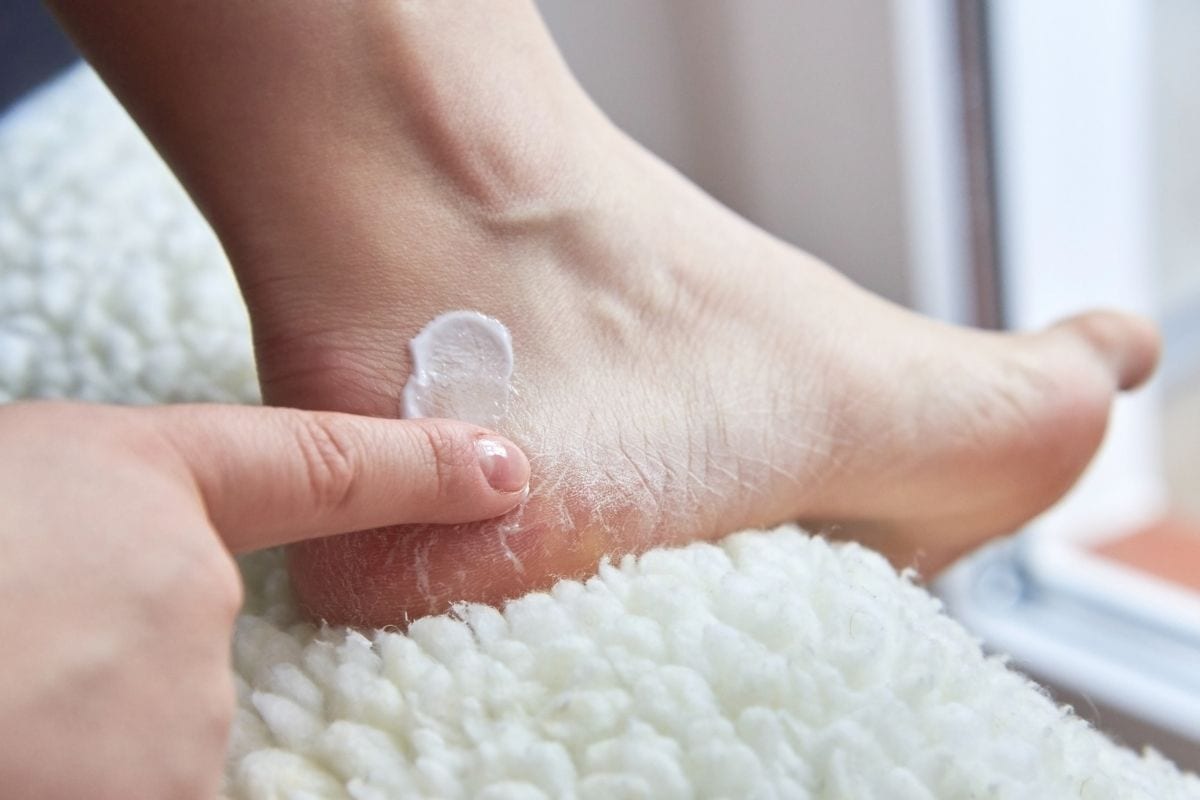Cracked skin on feet| footcare | Hansaplast