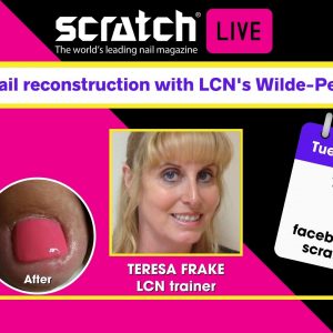 Live lcn wilde pedqique teresa frake toenail