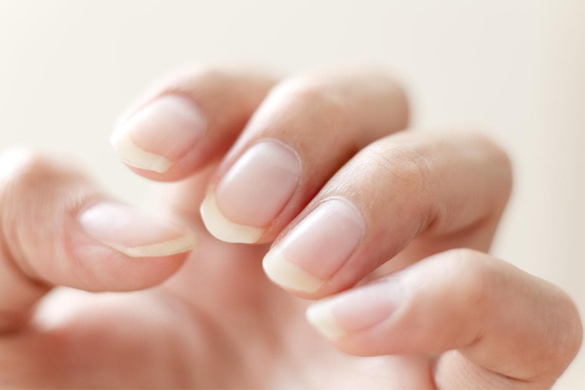 What Those Vertical Lines On Your Nails Mean About Your Health