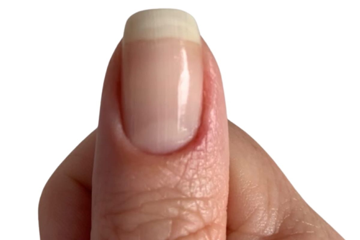 What Does The Half Moon Shape On Your Nails Mean? - Boldsky.com