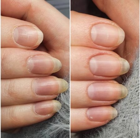 What is the function of the free edge of the nail? - Scratch Magazine