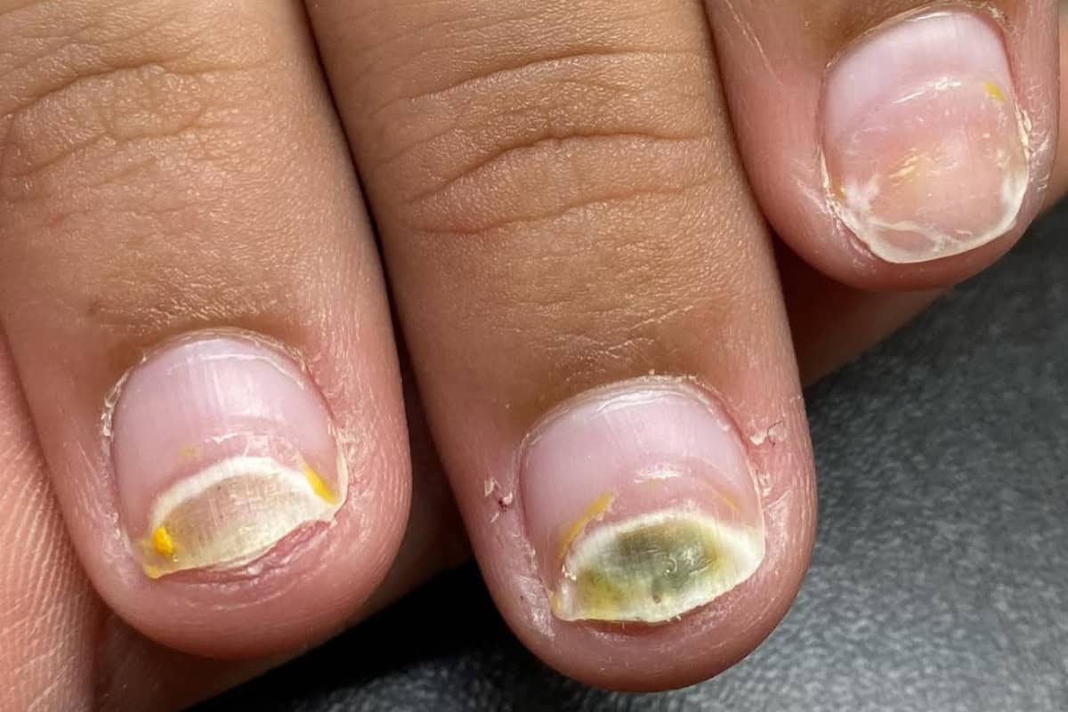 Instagram.com:nailsavvyy greenies nails is it mould Instagram.com:nailsavvyy greenies nails is it mould