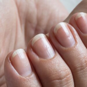 What is the nail matrix?