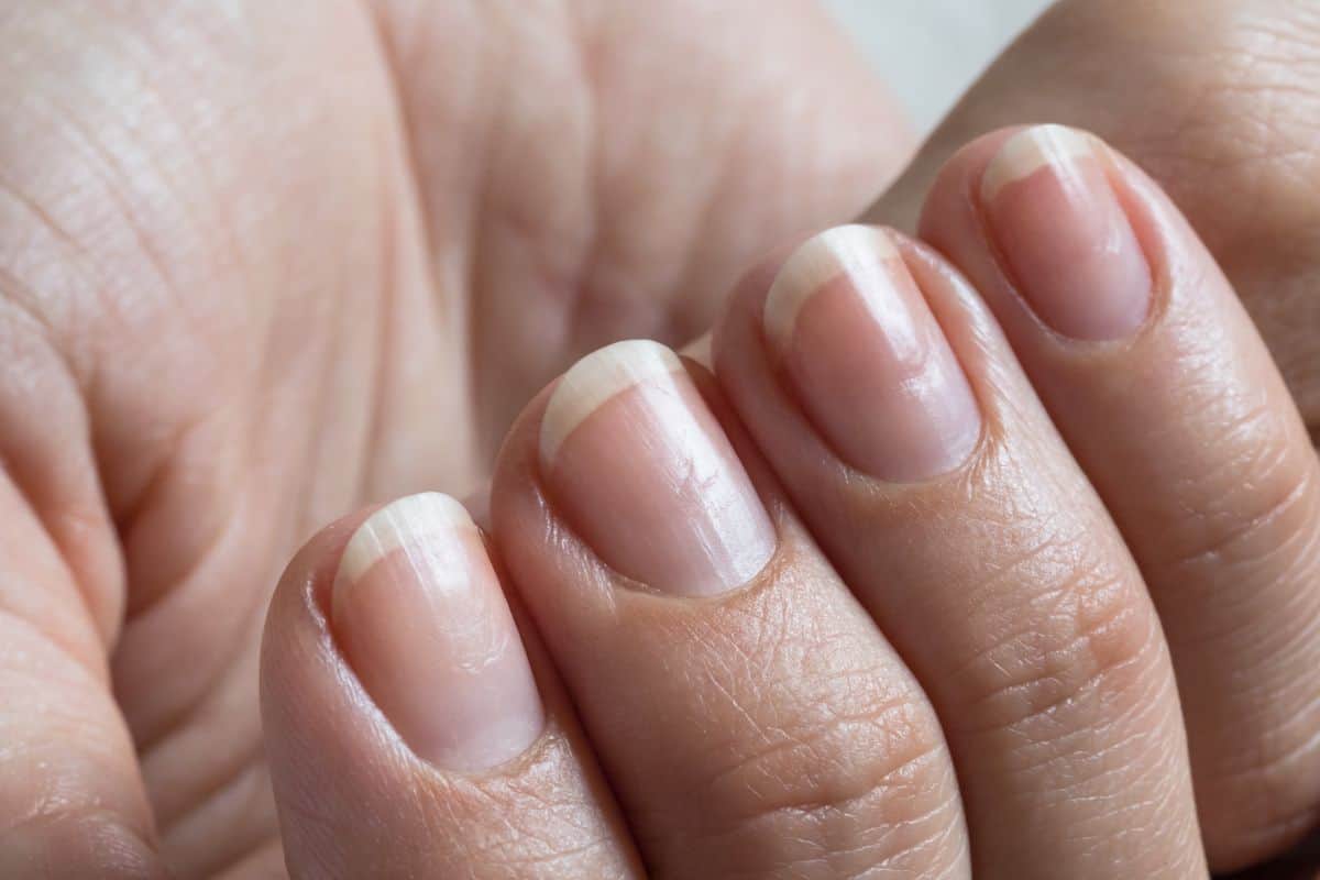 What is the nail matrix? What is the nail matrix?